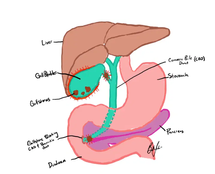 gallbladder