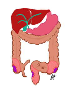 colorectal